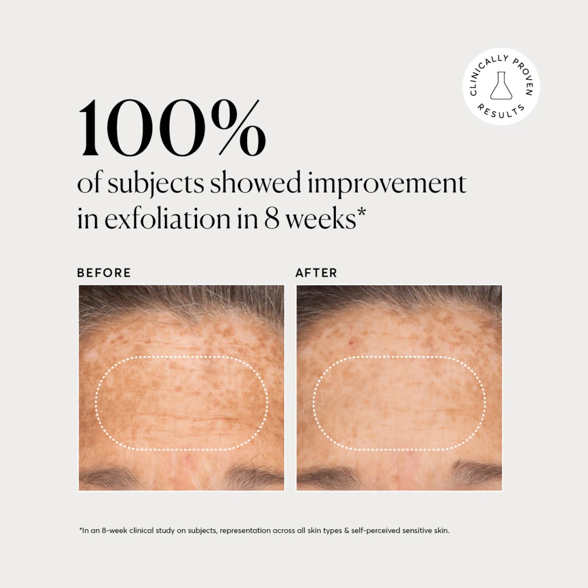 bha-liquid-exfoliant-2-u9 NATR-10027-Alt-Images-BHA-Liquid-Exfoliant-2_-03.webp